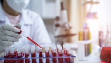 A tray of blood samples is prepared