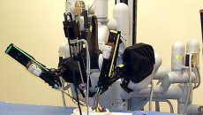Robotic surgery