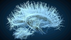 Image of brain