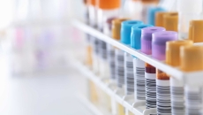 Lab test tubes