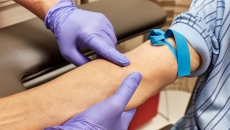 Why testing all adults for Hepatitis C is cost-effective