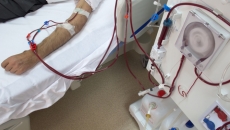 A cost-saving hemodialysis treatment