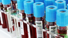 Novartis leukemia drug cost