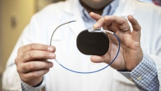 Doctor holding pacemaker