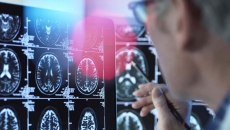 Doctor examines brain scans