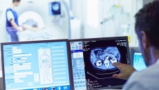 Doctor looking at radiation images