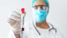 Person in PPE holds vial labeled monkeypox virus. Photo: bymuratdeniz/Getty Images