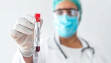 Monkeypox virus test