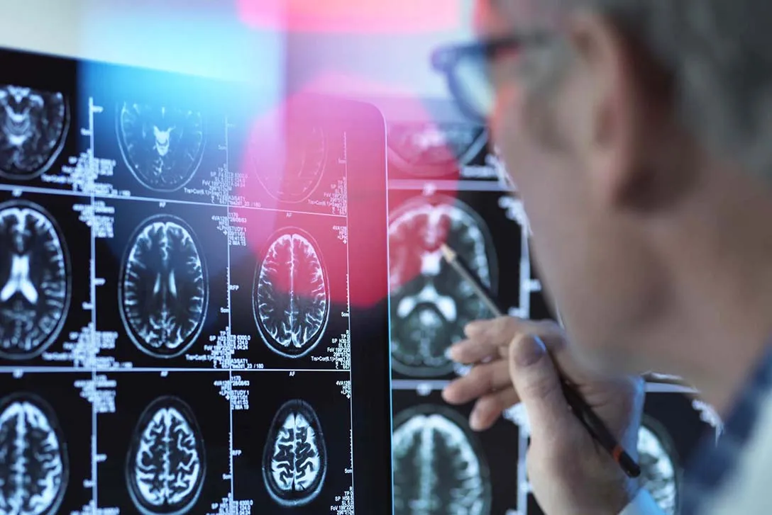 Doctor examines brain scans Doctor examines brain scans