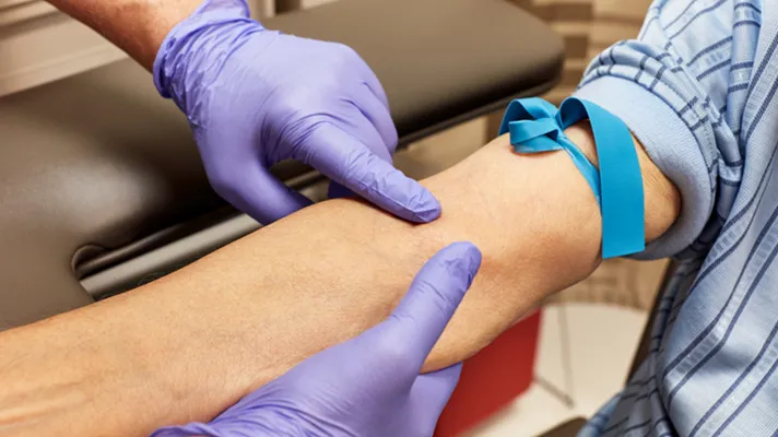 Why testing all adults for Hepatitis C is cost-effective