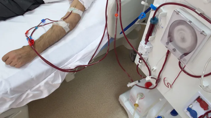 A cost-saving hemodialysis treatment