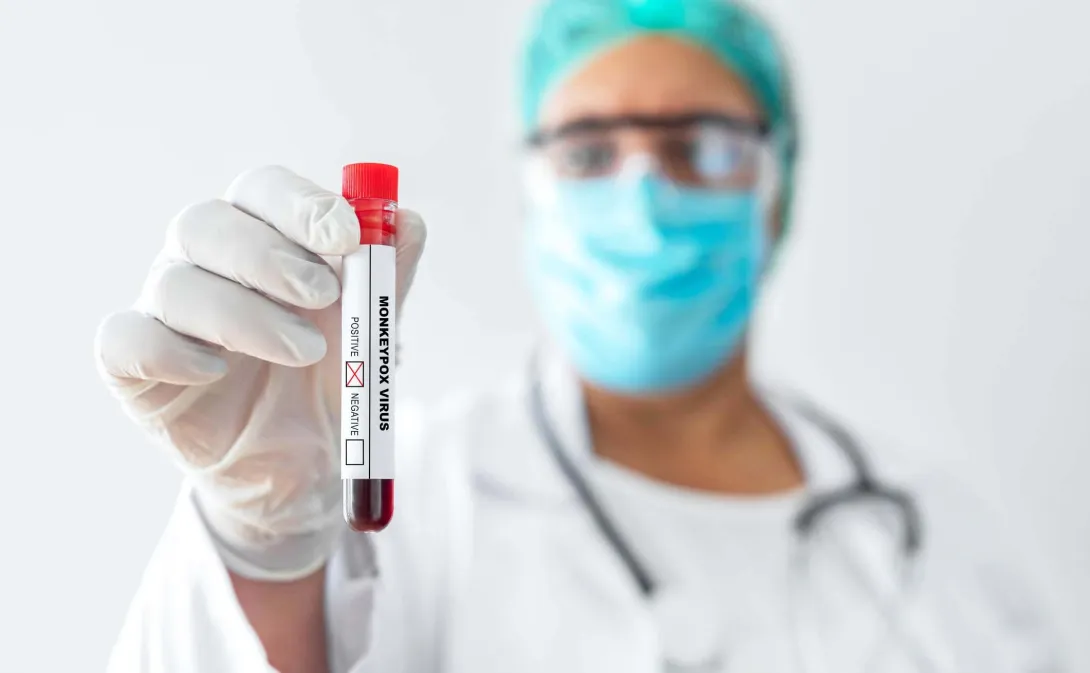 Person in PPE holds vial labeled monkeypox virus. Photo: bymuratdeniz/Getty Images