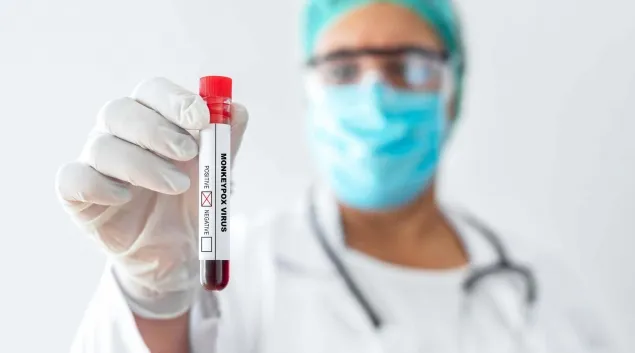 Monkeypox virus test